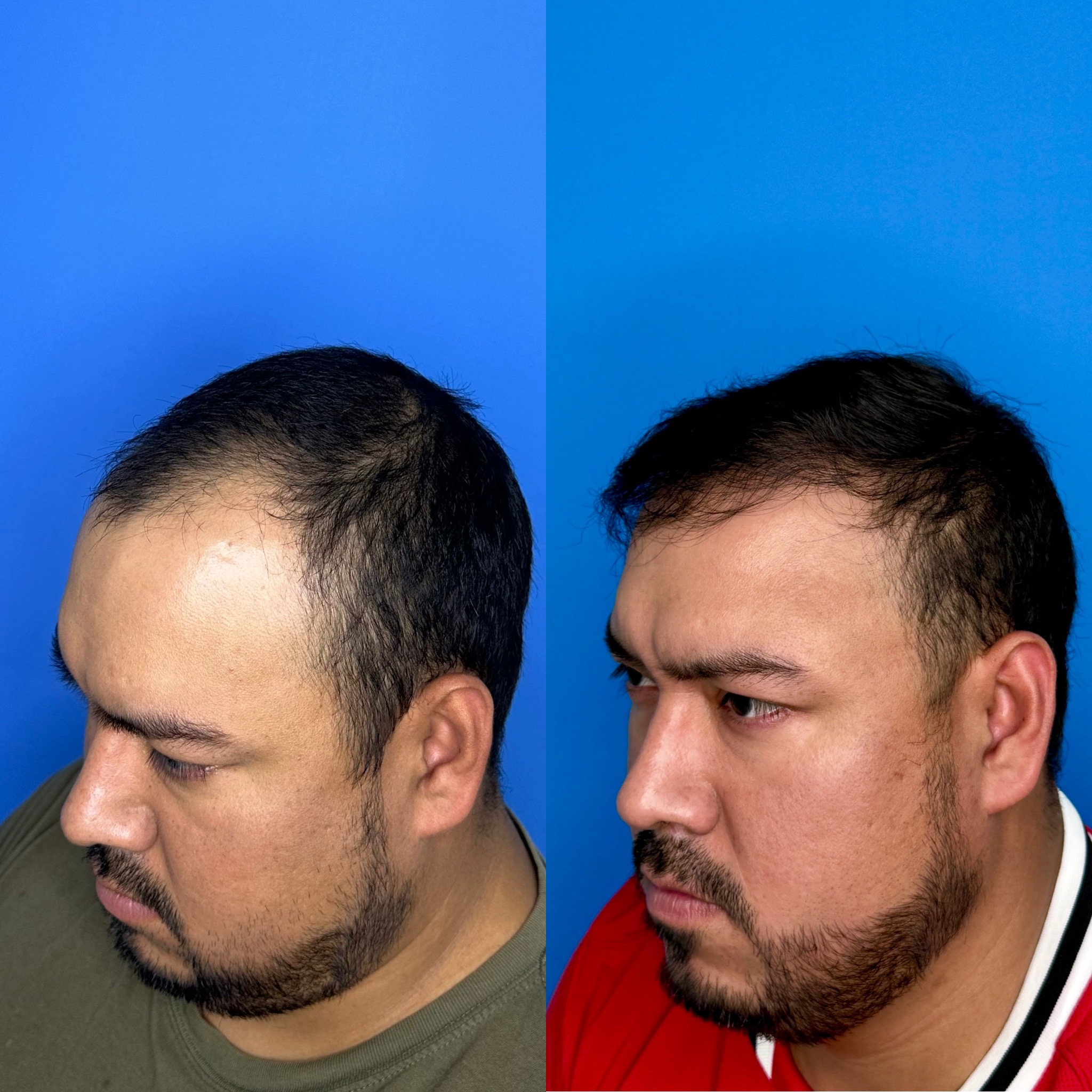 Caso Oscar 10 meses(1)