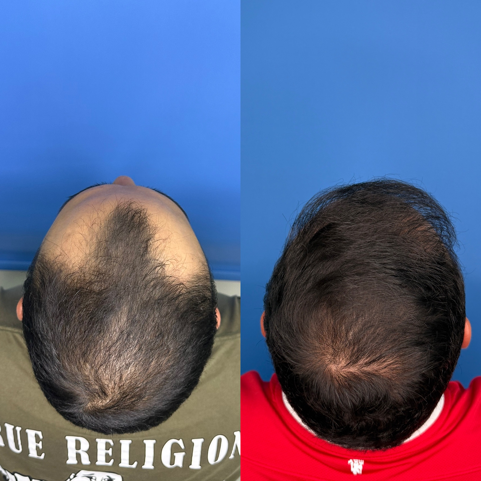 Caso Oscar 10 meses(2)