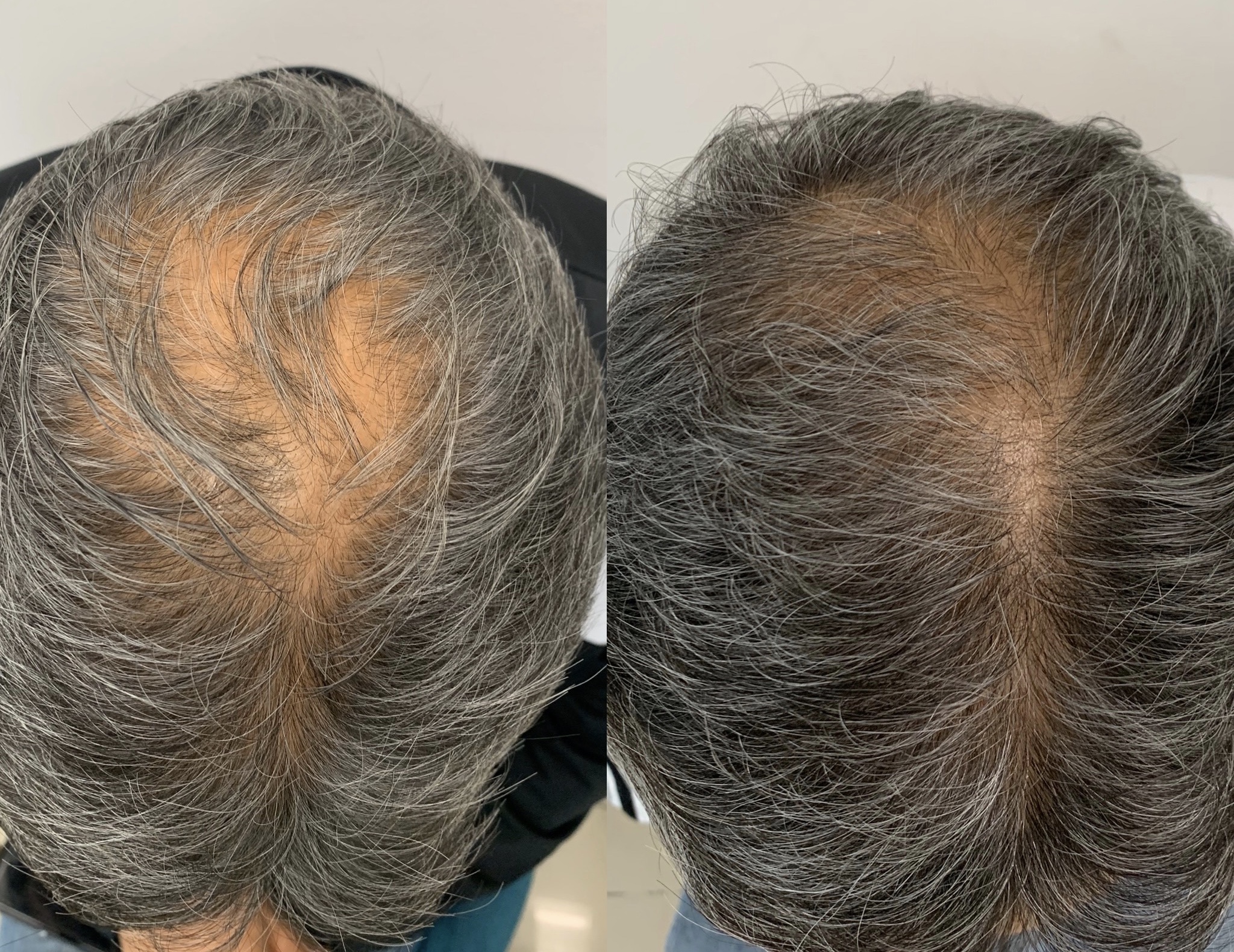 8251BE55-6559-4875-90B3-C6B21AD6DA3C(1)