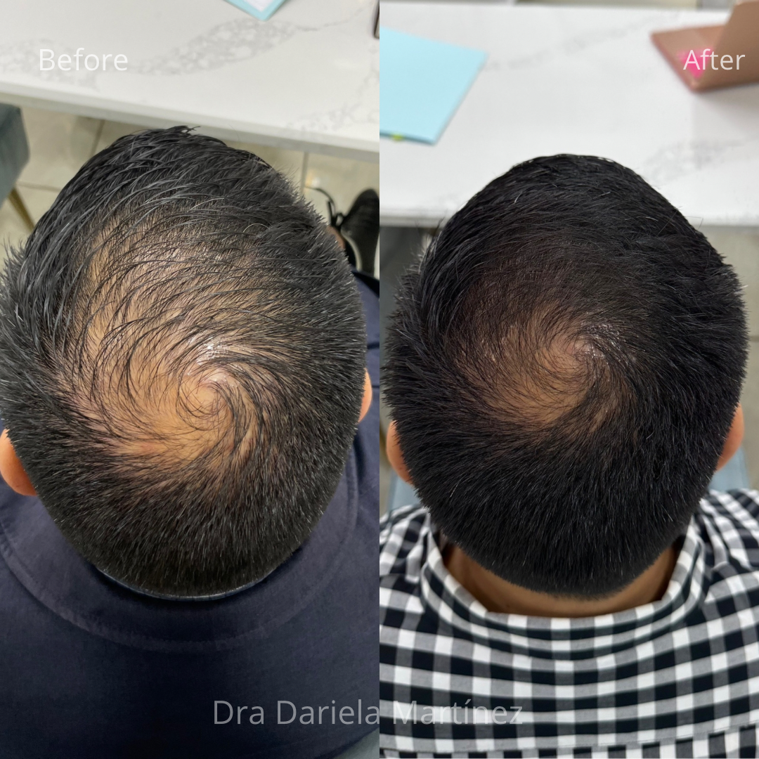 BFBA591A-3375-4A7F-864D-AA394A73F261