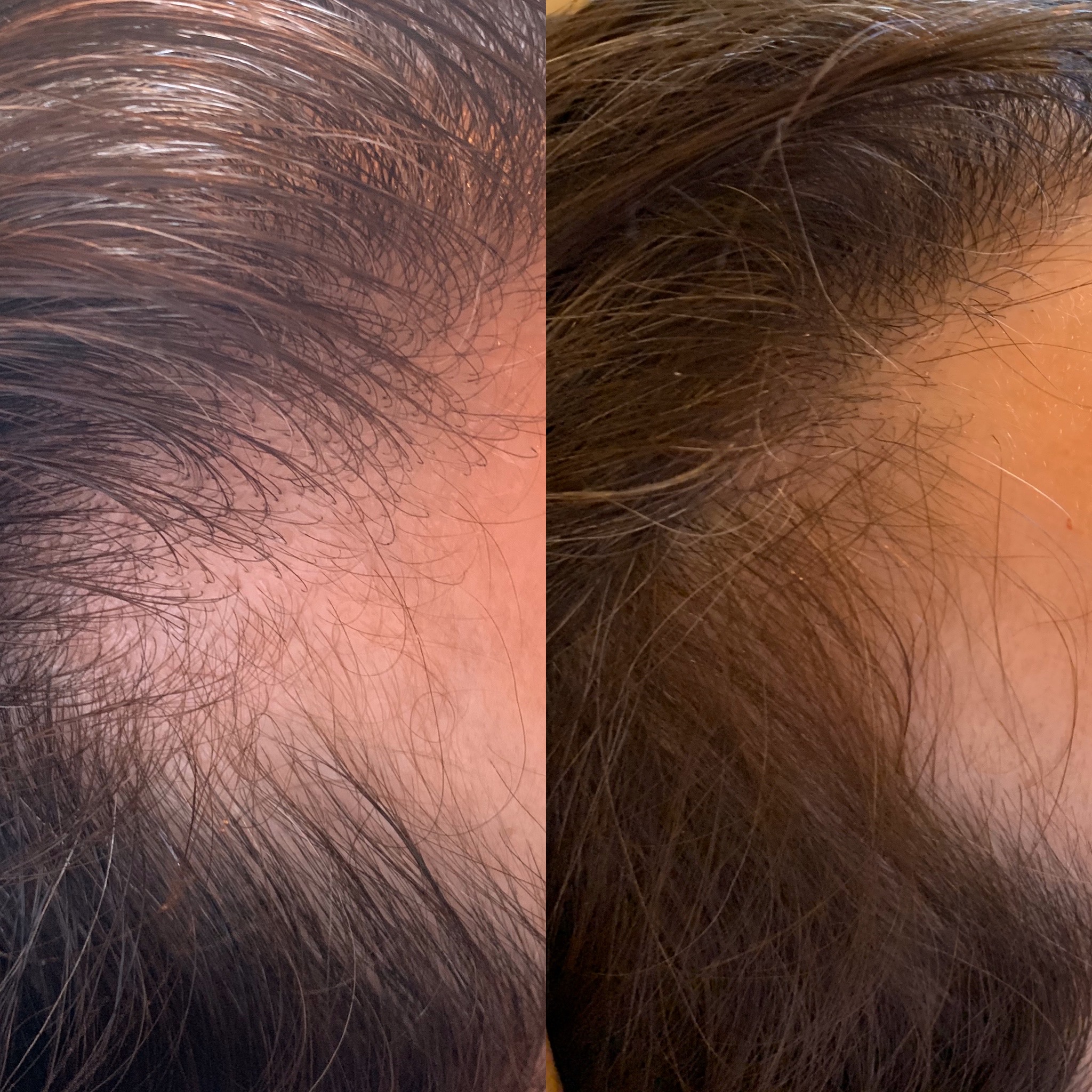 DA6F2C15-C13C-4BB2-88B9-7DD1D4AEF413