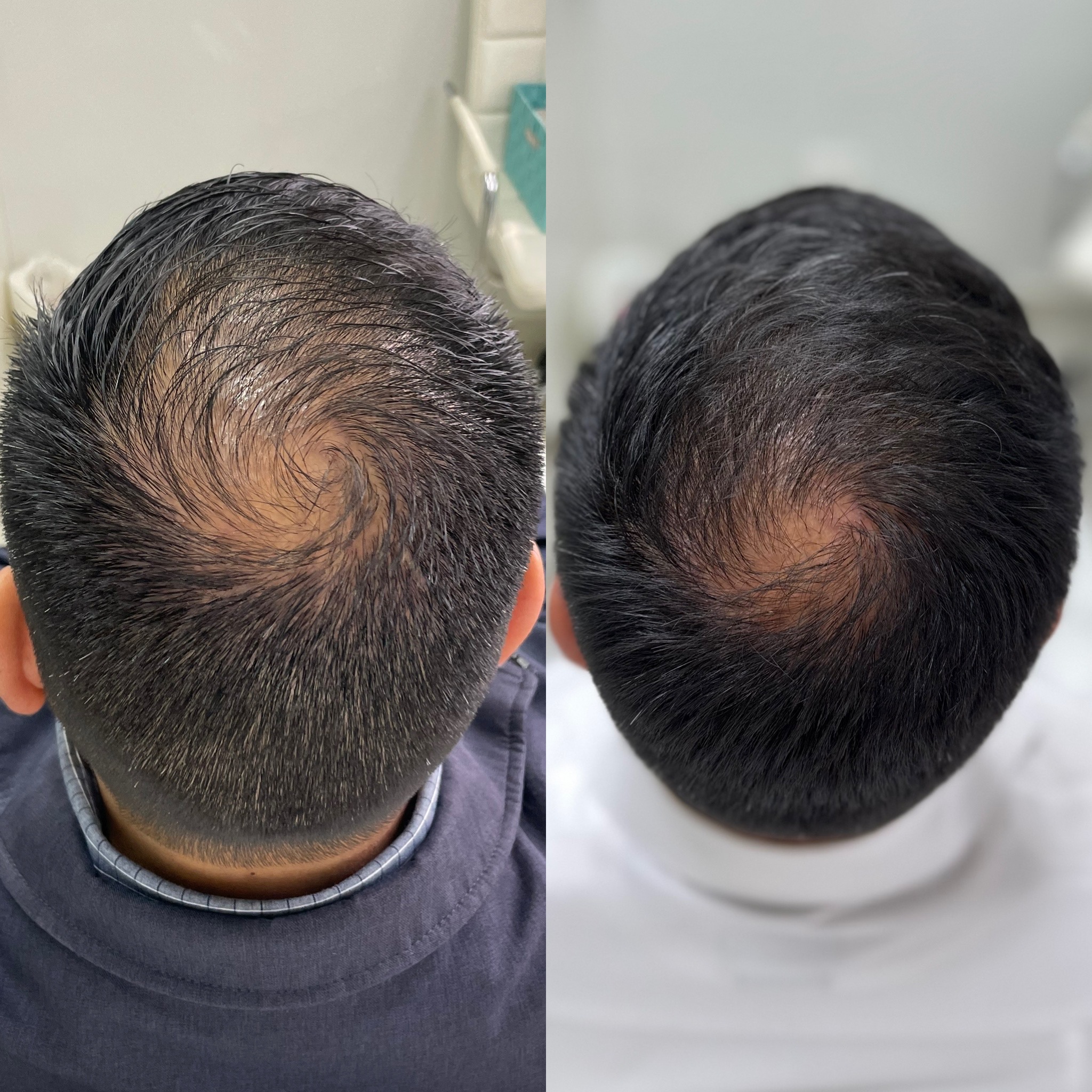 EB6114B7-B779-4CB8-A705-1984D460CBD9