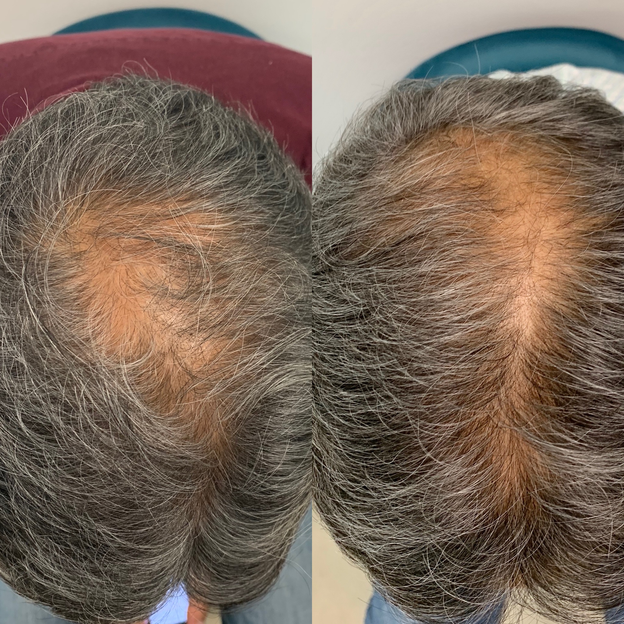 EF367B8D-3E14-4BFF-A50F-EF7075BE3EAE